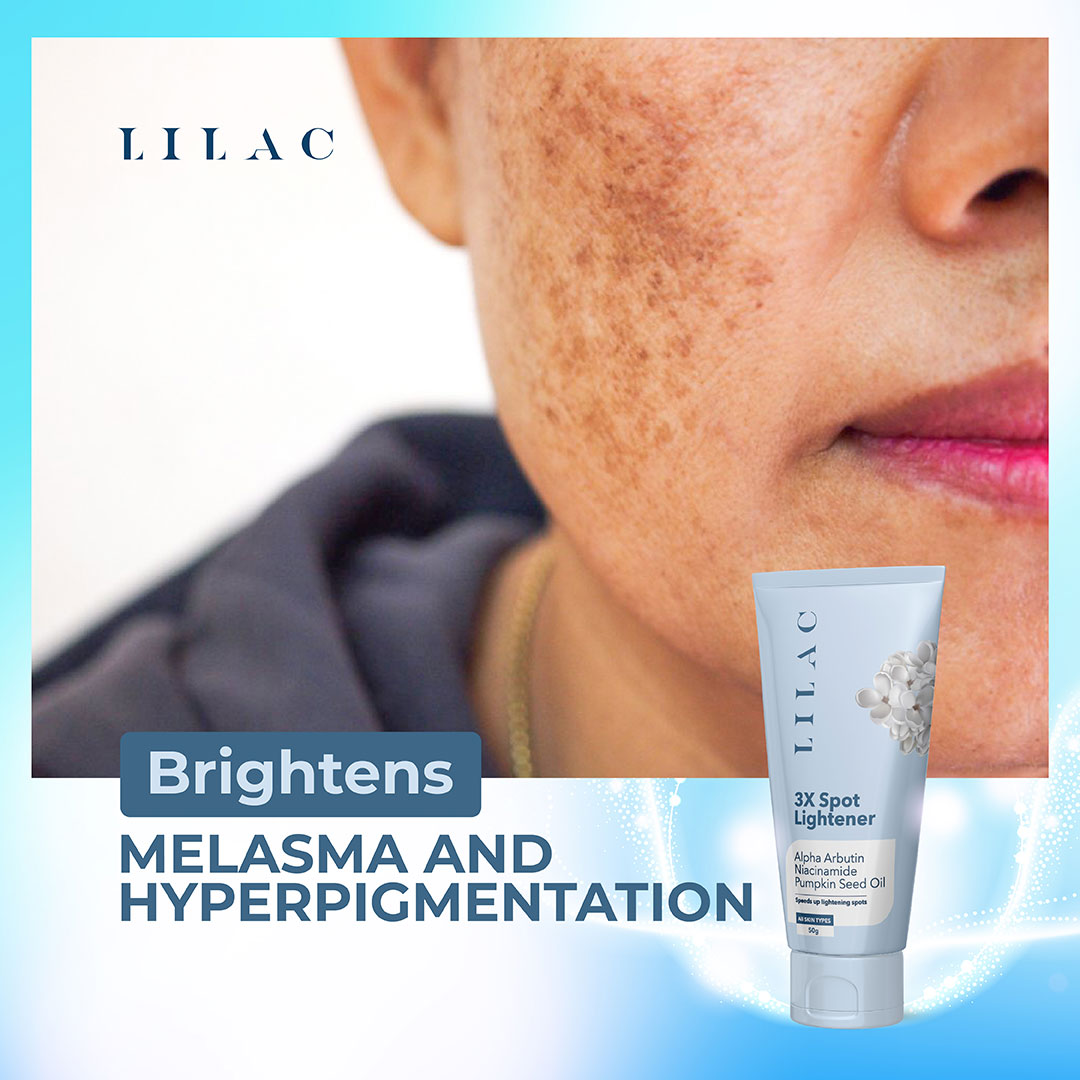 Lilac 3X Spot Lightener